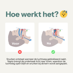 Naply™ - Snurkbeugel PRO MAX